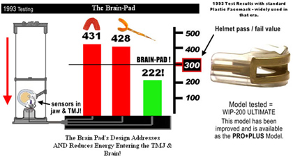 Brain-Pad 1993 Test