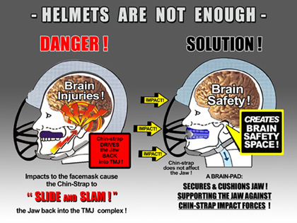 Schutzfunktion mit Helm