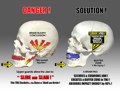 Protection Techniek